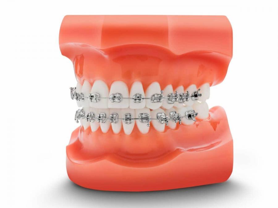 Orthodontisch